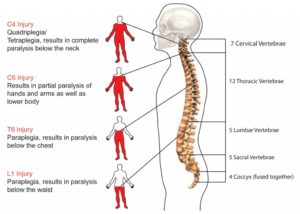 spinal cord injury levels